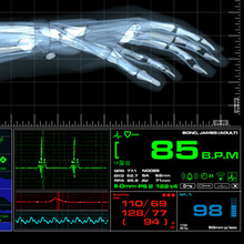Fictional Medical Device UI for <cite>Casino Royale</cite> (2006)