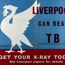 Liverpool Can Beat TB