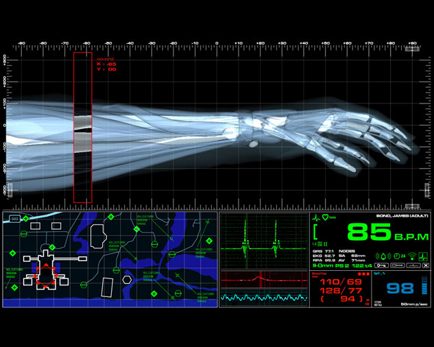 Fictional Medical Device UI for Casino Royale (2006) 1