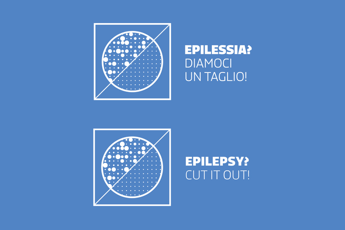 Epilepsy? Cut it out! 1