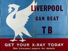 Liverpool Can Beat TB